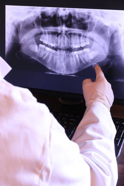 Best Knocked-Out Tooth Emergency  in Cade, LA